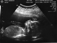 BABY PRINCE!